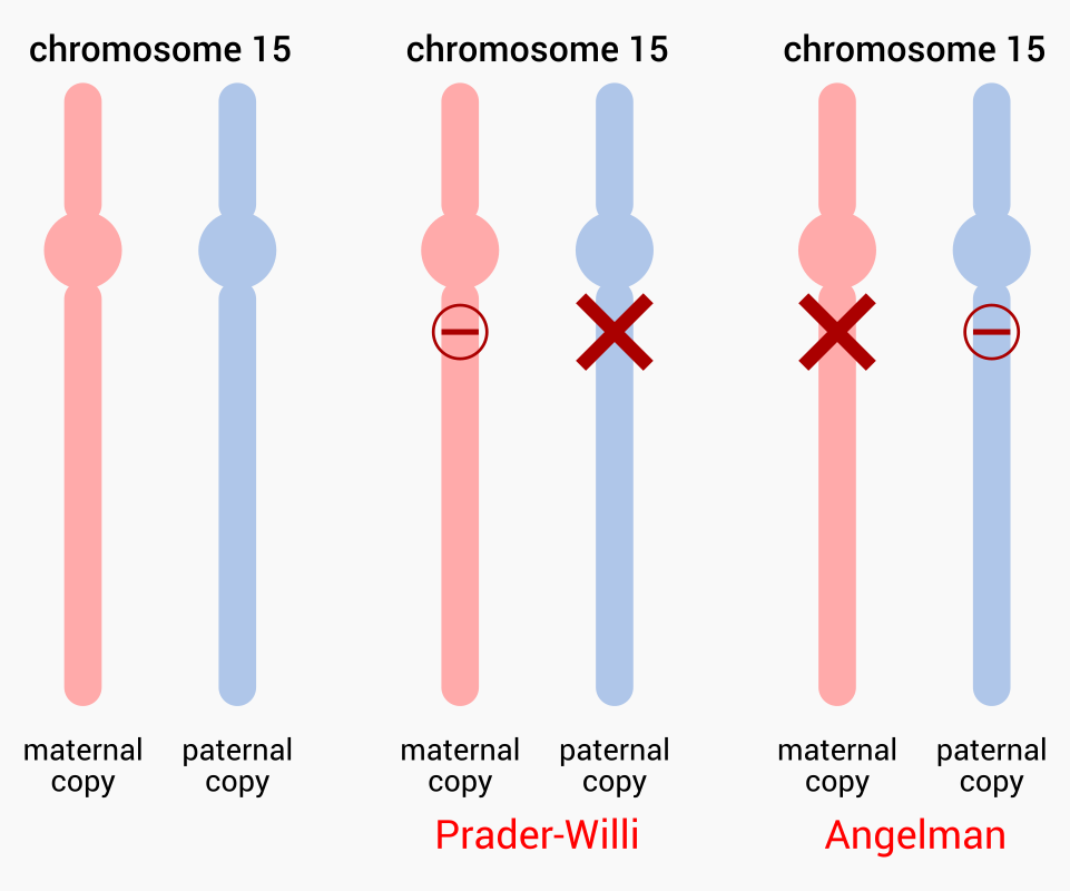 Prader Willi And Angelman Syndrome Caspershire Meta